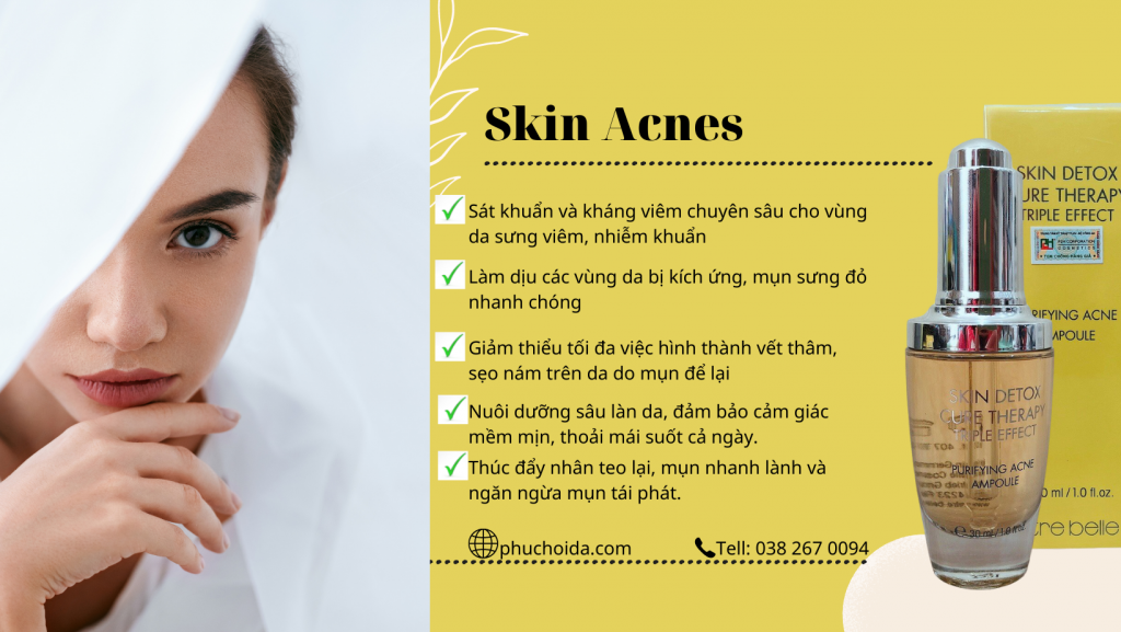 skin-acne